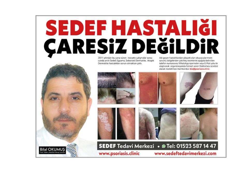 Sedef Hastalığının Nedenleri