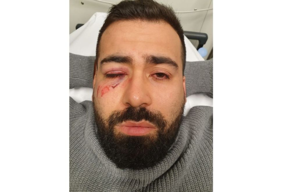 Alman Polisinden Hala Özür Gelmedi