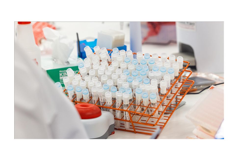 İsveç, Afrika Bölgesi Dışında İlk Mpox Vakasını Bildirdi
