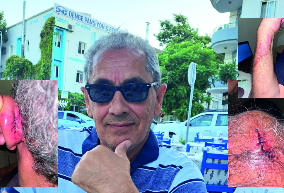 Saldırıya Uğradı, Ölümden Döndü, Saldırgan Serbest Bırakıldı