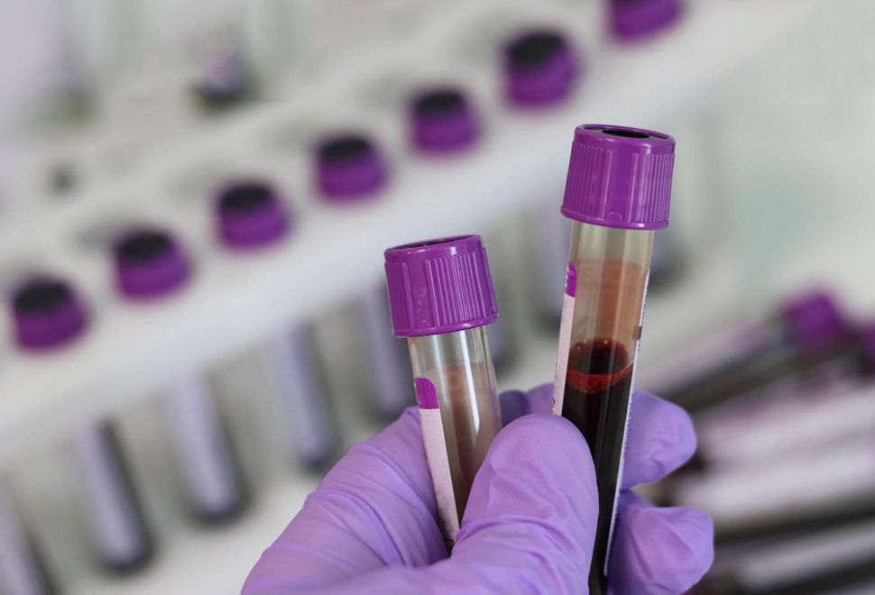 Kan Kanserinde Yenilikçi Tedavi Yöntemleri Umut Veriyor